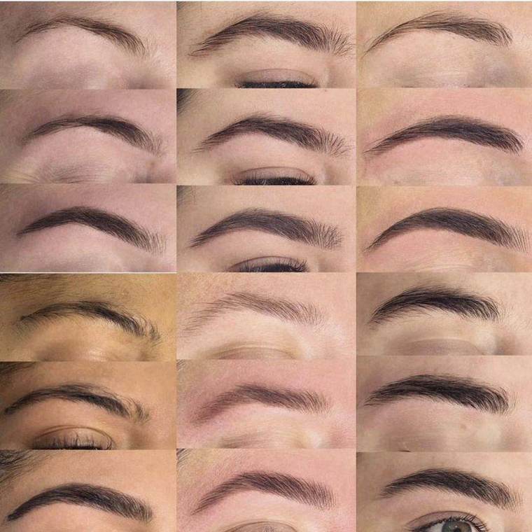 Before and after