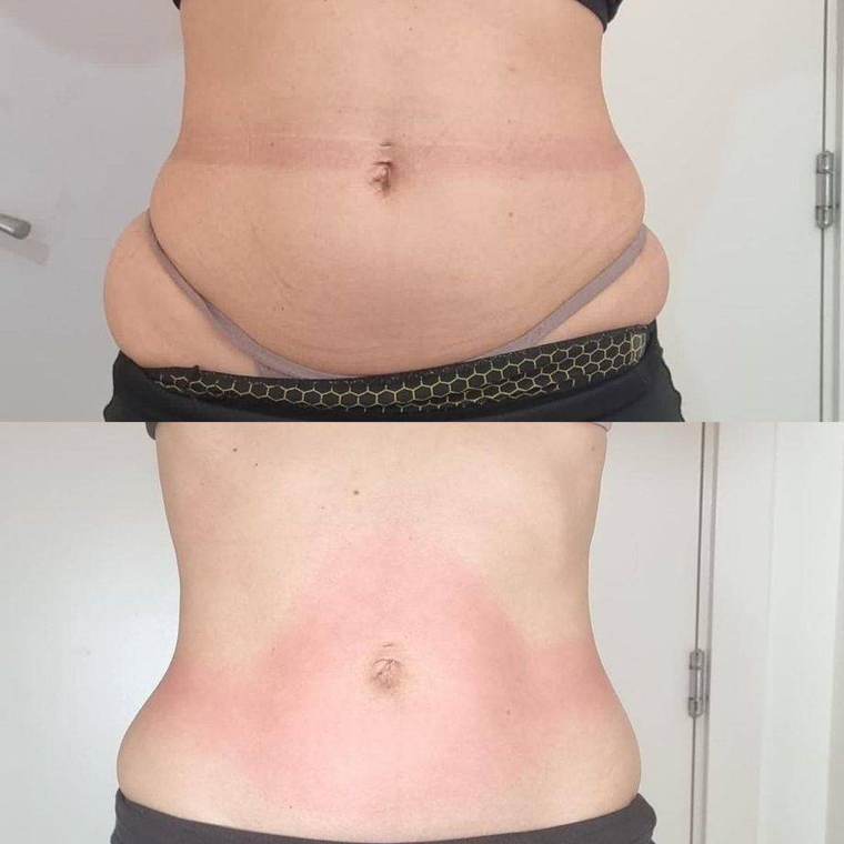 Before and after