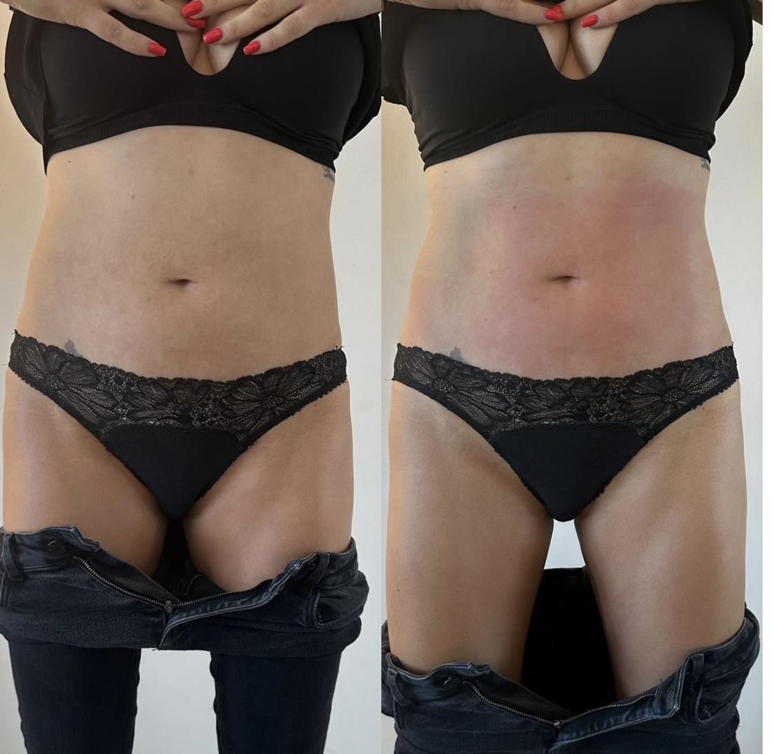 Slim Drone abdomen front