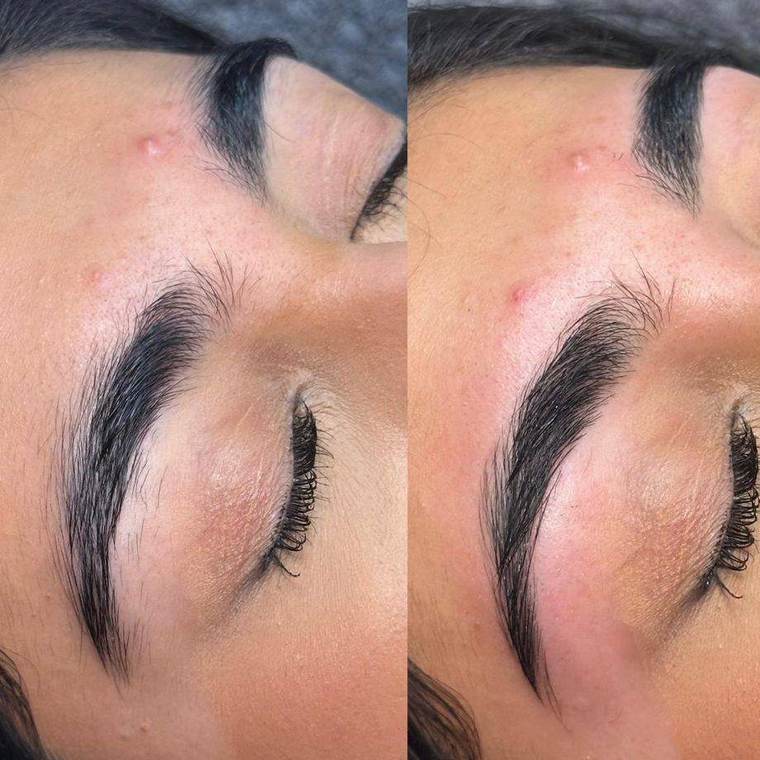 Before and after