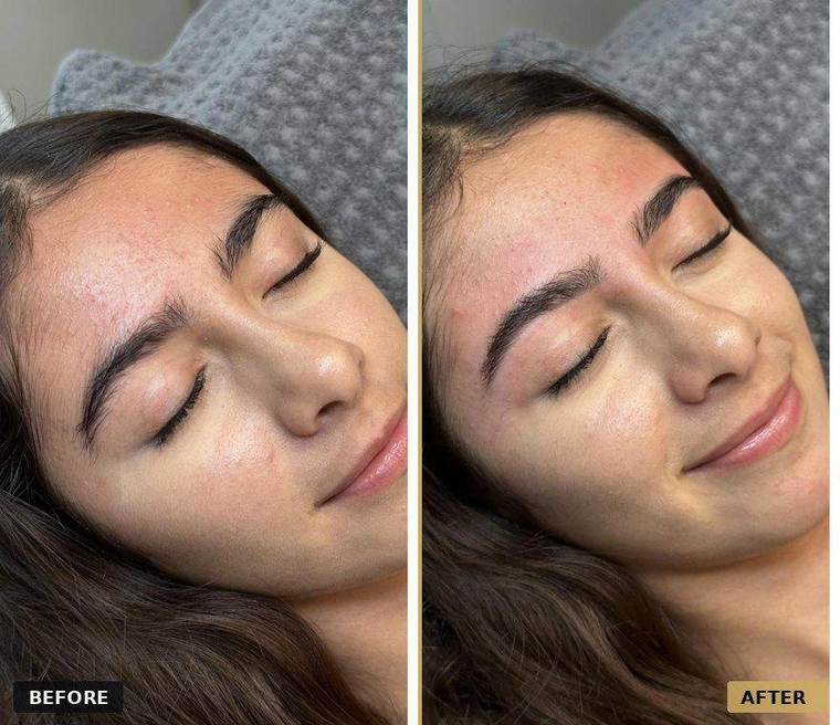 Before and after