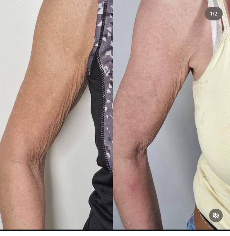 Before and after