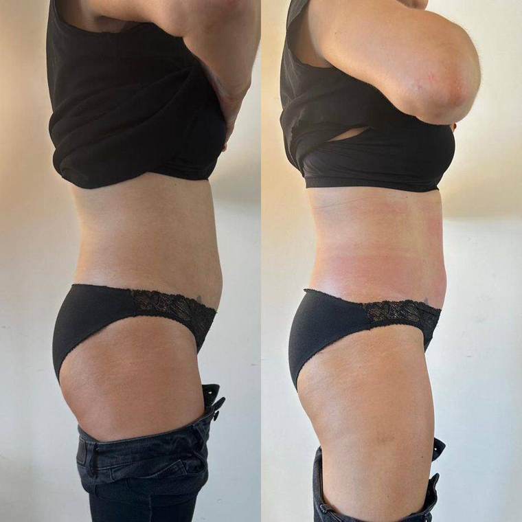 Before and after