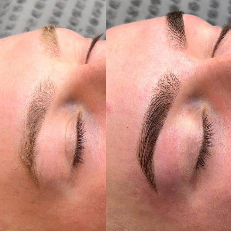 Before and after