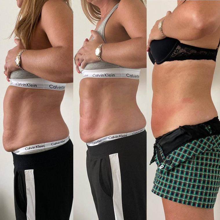 Before and after