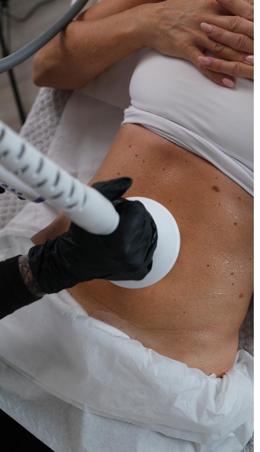 Lipofirm Med treatment