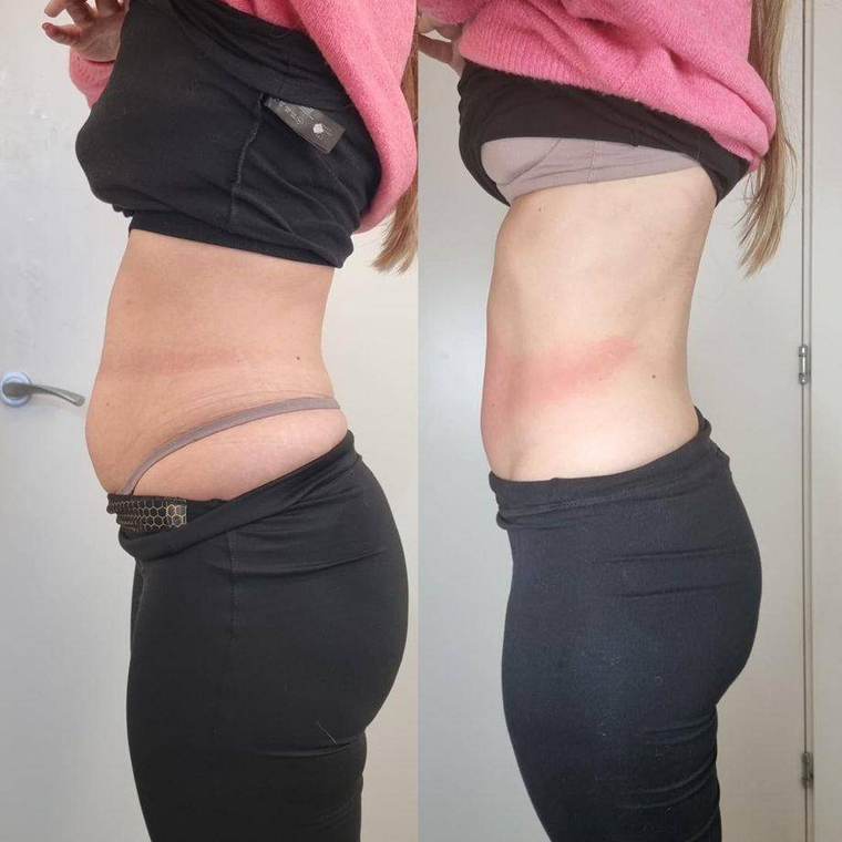 Before and after