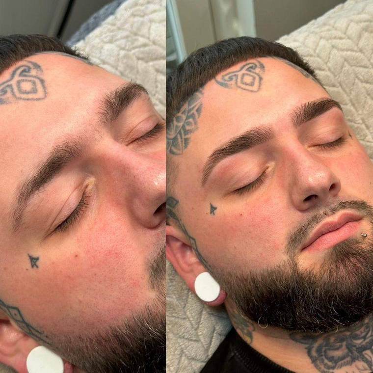 Before and after