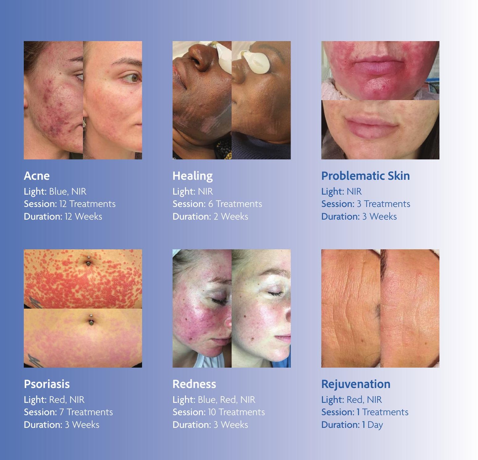 Dermalux clinical results — acne, healing, problematic skin, pigmentation, psoriasis, redness